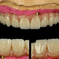 Digital Supplies - Zirconia - Sagemax NexxZr + Multi 2.0