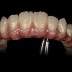 Digital Supplies - Zirconia - Aidite 3D Pro Zir Ultra
