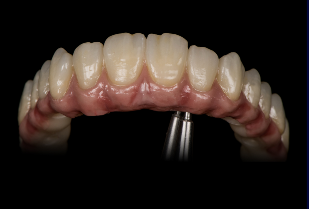 Digital Supplies - Zirconia - Aidite 3D Pro Zir Ultra