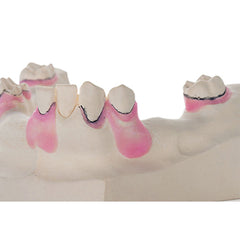 Wax - Block-Out Wax