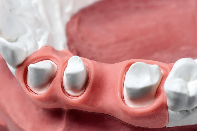 Gingival Reproduction Material