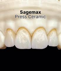 Supplies - Pressables - Sagemax PressCeramic