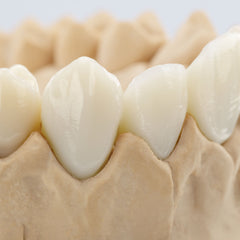 BEGO VarseoSmile Crown