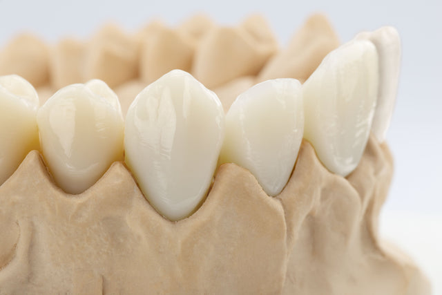BEGO VarseoSmile Crown