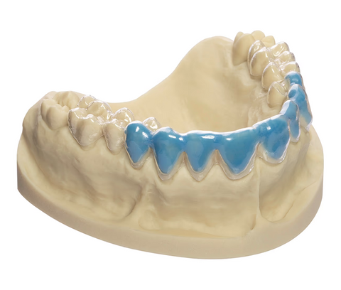 BioBleach Hard Bleaching Trays