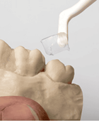 Dreve Fillin Silicone Block Out Putty