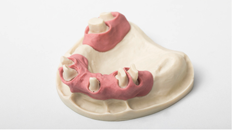 Dreve GumQuick Gingiva Mask - Refill