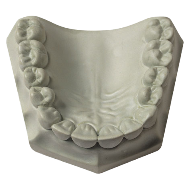 Whip Mix HARD ROCK GREEN 33#/15KG