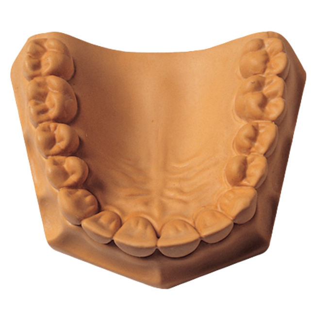 Whip Mix MICROSTONE GOLDEN 80/140G