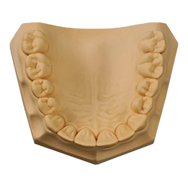 Whip Mix RESINROCK GOLDEN BROWN 33#/15KG