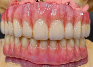 Sagemax NexxZr T 98MM - White