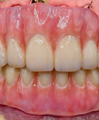 Sagemax NexxZr T 98MM - White