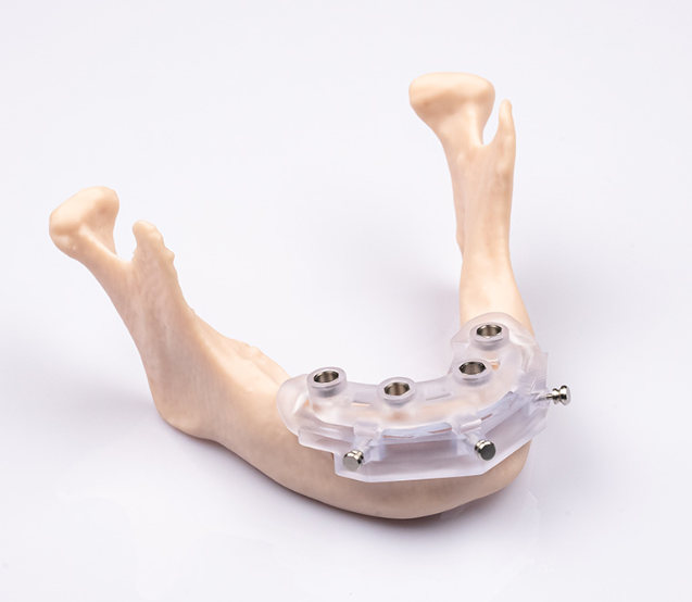 HeyGears UltraPrint Dental Surgical Guide UV