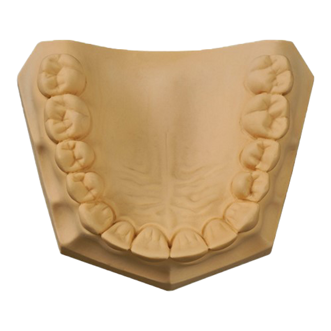 Whip Mix ULTIROCK GOLDEN BROWN 33#/15KG