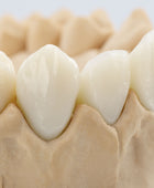 BEGO VarseoSmile Crown plus D3, 250 g