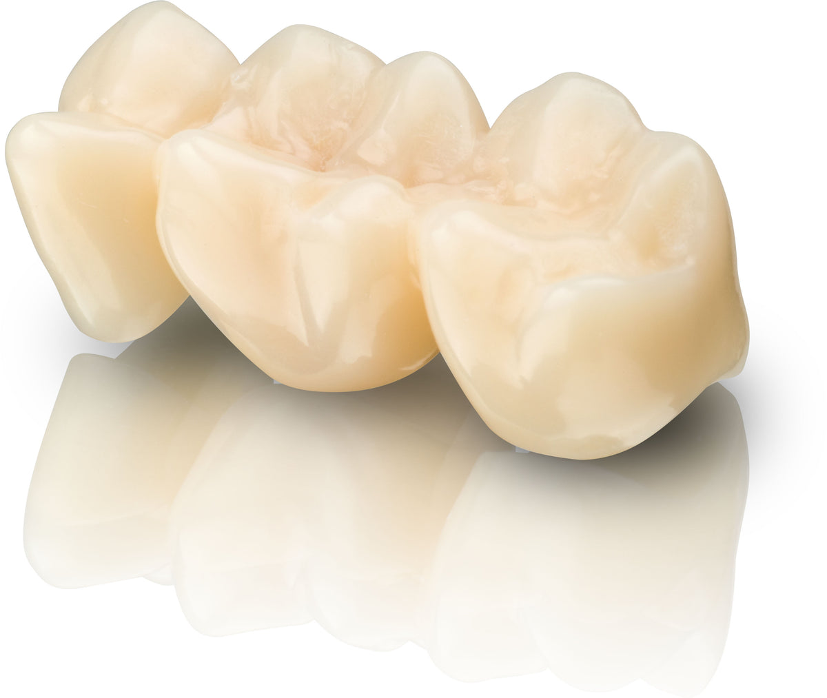 BEGO VarseoSmile Temp A3, 250g