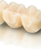 BEGO VarseoSmile Temp A3, 250g