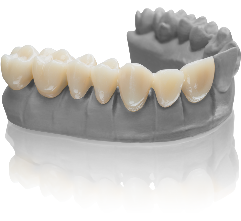 BEGO VarseoSmile Temp A3, 250g