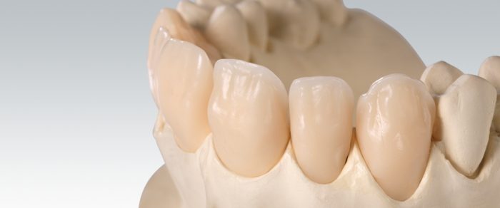 Amann Girrbach Ceramil A-Temp 98x14