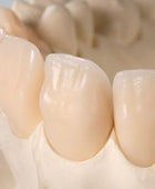 Amann Girrbach Ceramil A-Temp 98x14