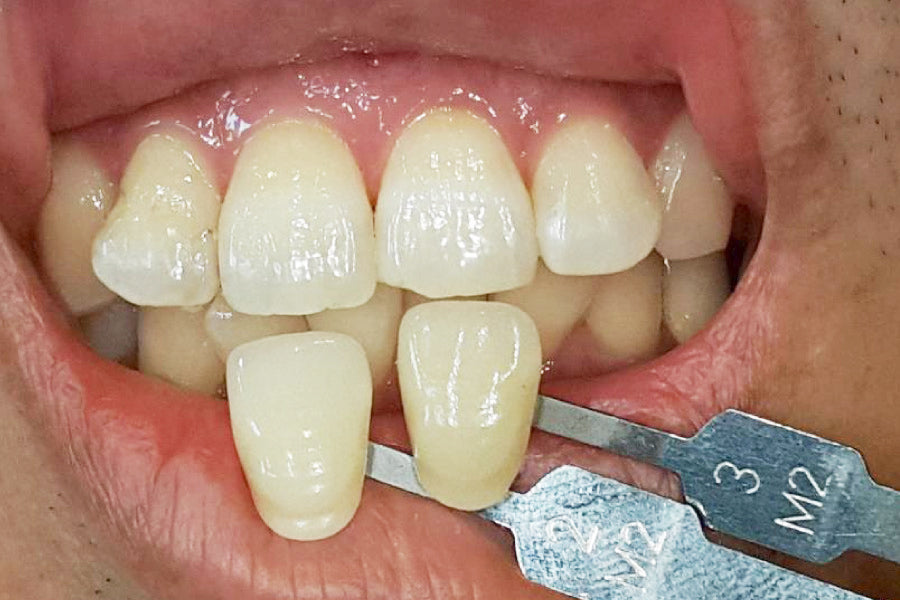 Hass Bio Mobile Light for Dental Photography