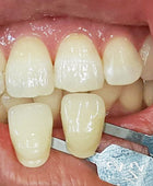 Hass Bio Mobile Light for Dental Photography